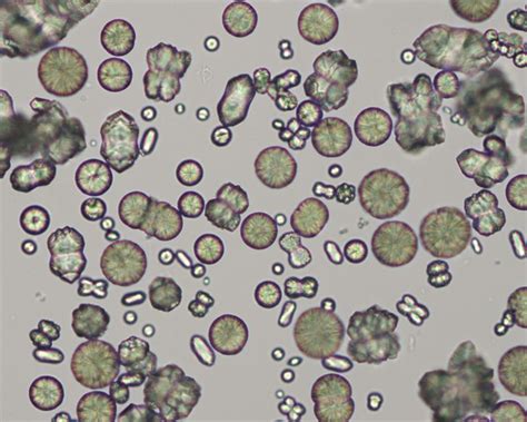 Normal Range Of Uric Acid In Urine