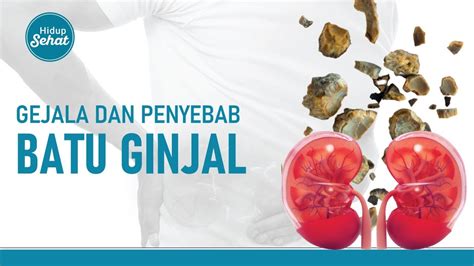 Gejala Dan Penyebab Batu Ginjal Yang Jarang Disadari Hidup Sehat