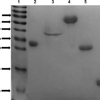 Identification of the correct expression and purification of the ...