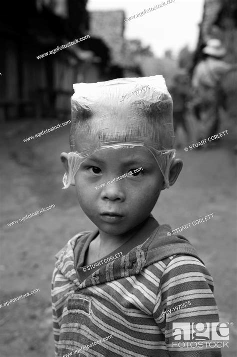 Karen Refugee Child At Mae La Refugee Camp Maesot Thailand Stock