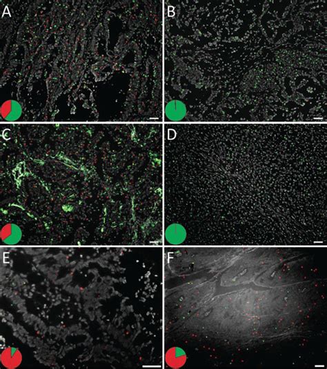 In Situ Mutation Detection Of Codon 12 And 13 Kras Mutations On A D