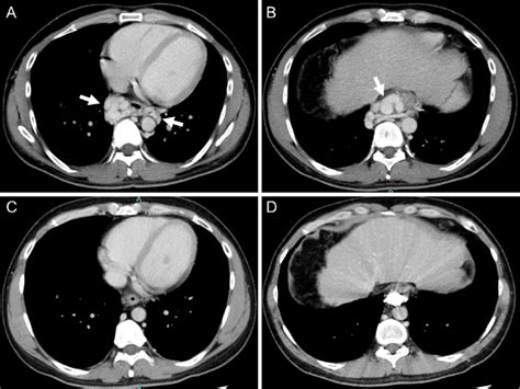 Figure1a B Dynamic Contrast Enhanced Computed Tomography Ct