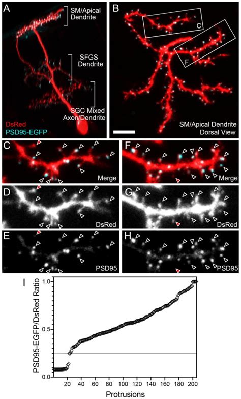 NMDA Receptor Antagonist MK801 Reduces Dendritic Spine Density And