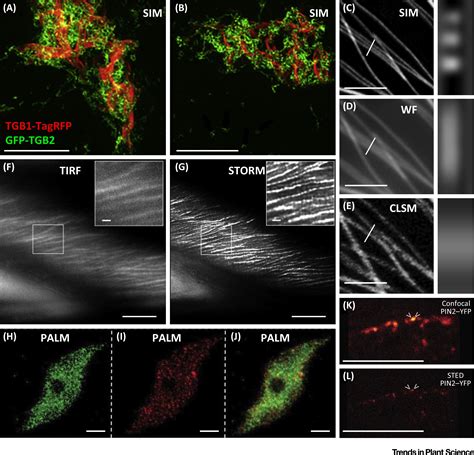 Super Resolution Microscopy In Plant Cell Imaging Trends In Plant Science