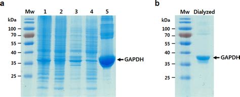 Sds Page Analysis Of Recombinant Gapdh Expression Coomassie Brilliant