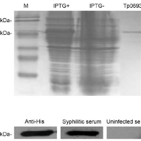 Expression, purification and identification of recombinant protein ... 