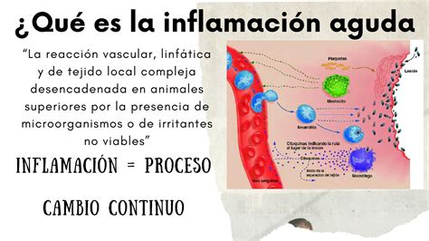 SOLUTION Respuesta Inflamatoria Studypool