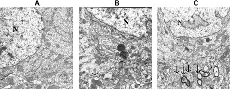 Electron micrographs of the hippocampus detected at 12 h following sham ... 