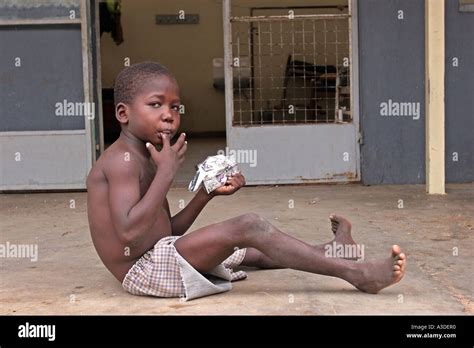 A child who has been receiving food therapy for being malnourished in ...