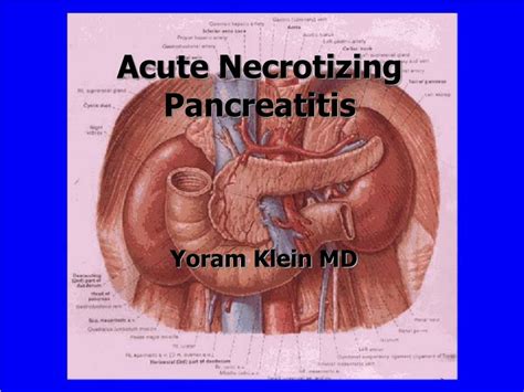 Ppt Acute Necrotizing Pancreatitis Powerpoint Presentation Free Download Id 4491931