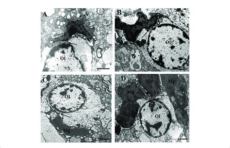 These Micrographs From Layer 5 Of The Prefrontal Cortex Show