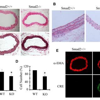 Smad2 And MRTFB Cooperatively Regulated VSMC Marker Gene Expression In