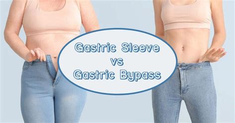 Gastric Bypass Vs Gastric Sleeve What S The Difference