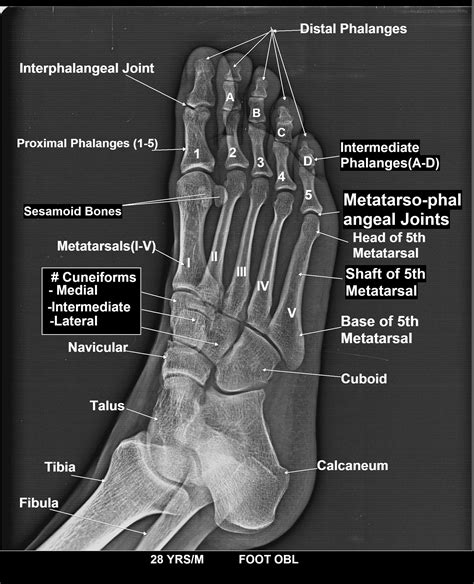 Foot obl x ray anatomy | Xray technician, X ray, Radiography