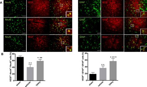 Tppu Increases Astrocyte Derived Vegf In The Cortex At Day 2 After Mcao