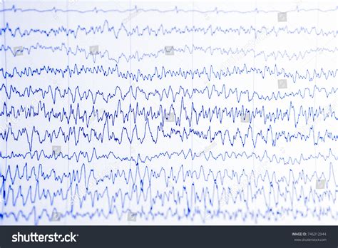 Eeg Wave Human Brain Brain Wave Stock Photo 746312944 | Shutterstock