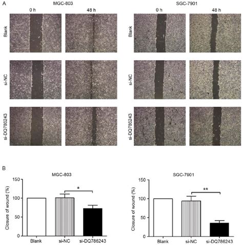 In Vitro Wound Healing Assay Of GC Cells A Representative