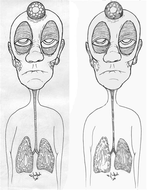 Tuberculosis Drawing By Dylan Bush Fine Art America