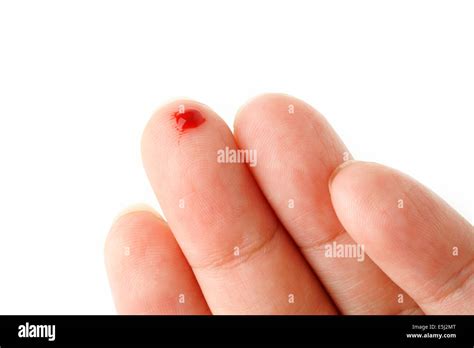 Hand Cut Blood Bleeding Hi Res Stock Photography And Images Alamy