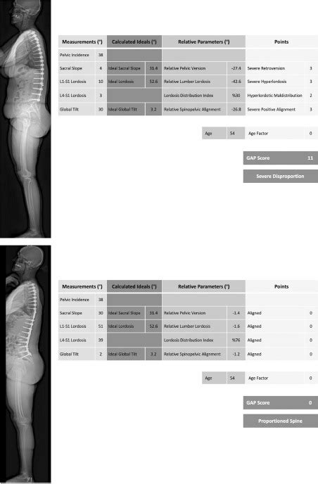 Evaluation Of Global Alignment And Proportion Score In An Independent