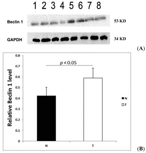 Ijms Free Full Text Beclin 1 Expression In Ovarian Tissues And Its