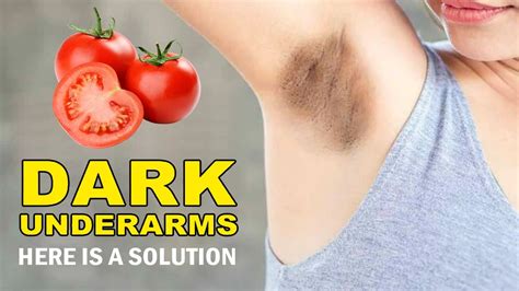 Whiten Dark Underarms Instantly Permanently 100 Works At Home Recipe