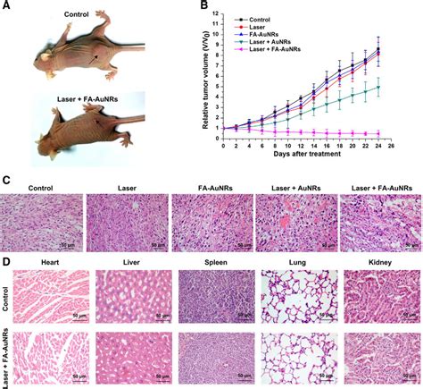 Photoacoustic Treatment Of Tumor Bearing Mice A Representative