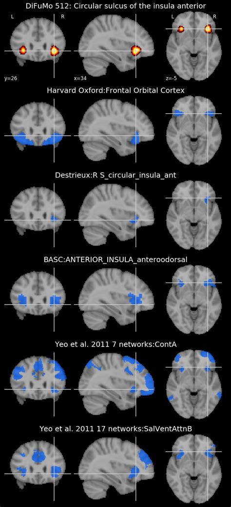 Circular Sulcus