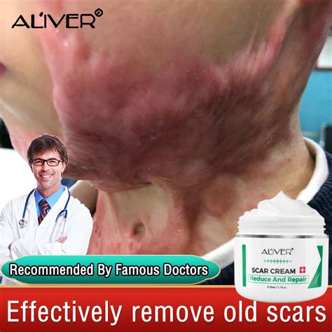 Original ALIVER Scar Repair Cream 50ml For Old Scar On Leg Stretch Mark