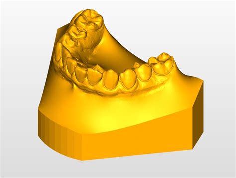 Fichier Stl Mod Les D Tude Orthodontique Maxillaire Et Mandibulaire