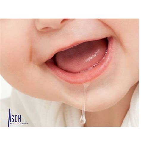 La Importancia De La Saliva En La Salud Bucal Dental Asch