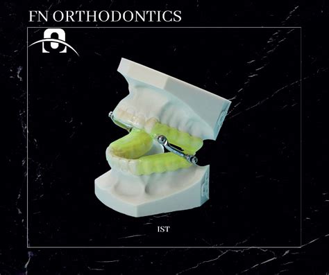 Obstructive Sleep Apnea Syndrom OSAS FN Orthodontics