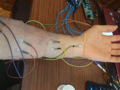 Surface Electromyography B Lab