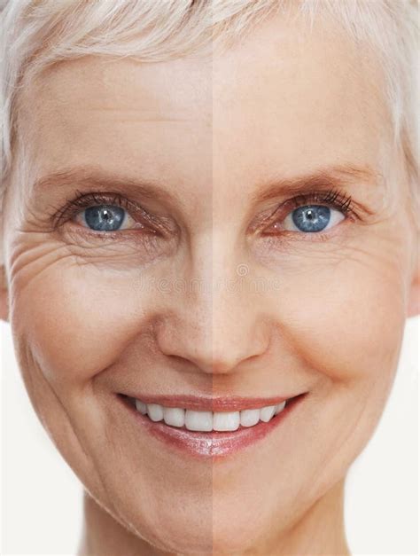 Aging Gracefully And Beautifully Before And After Shot Of A Beautiful