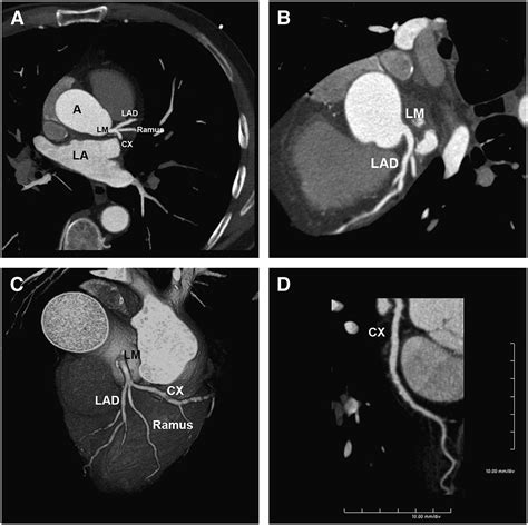 Cardiac Ct Indications And Limitations Journal Of Nuclear Medicine