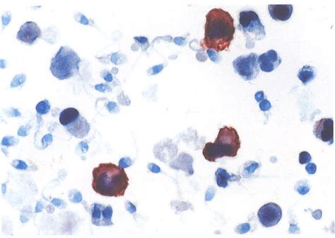 图3 26 精液中的淋巴细胞 基础医学 医学