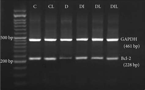 Semiquantitative Rt Pcr Analysis Of Expressions Of A Bcl 2 Gene In