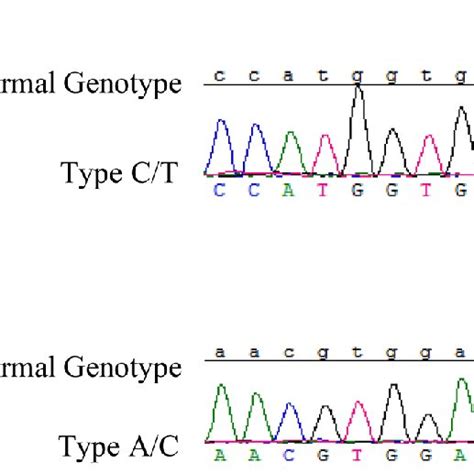 HbA1c sequence was tested using Sanger sequencing. The patient's HbA ... 