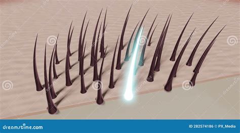 Hair Follicles Regeneration Concept Stock Illustration Illustration