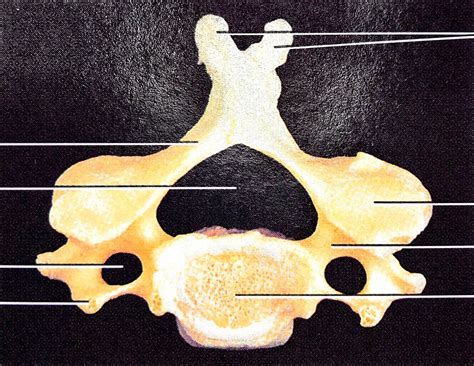 Vertebral Column Typical Cervical Vertebra Diagram Quizlet