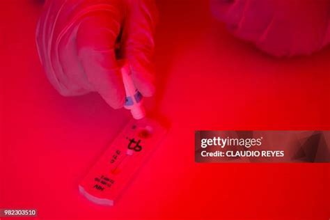 222 Hiv Rapid Test Stock Photos High Res Pictures And Images Getty