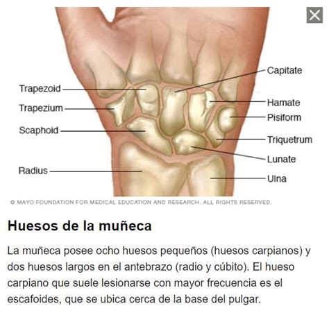 Fracturas De Mu Eca Reus Y Tarragona Traumat Logos