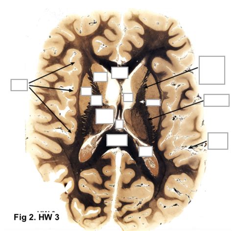 Neuroanatomy Horizontal Diagram Quizlet