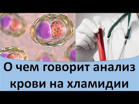 Анализ на хламидии у мужчин и что значит chlamydia trachomatis igg ...