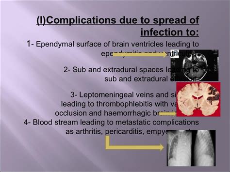 Complications of meningitis in children