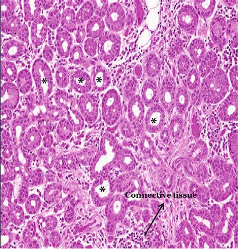 Lacrimal gland histopathology. H&E staining of a normal lacrimal gland.... | Download Scientific ...