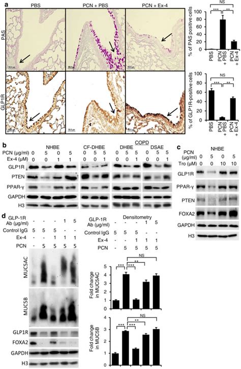 Exendin Ex Restores Glp R Ppar Pten Signaling Disrupted By