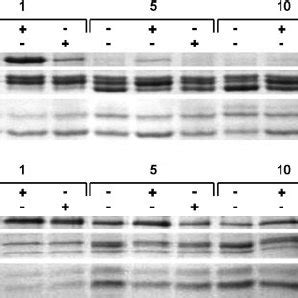 The Biphasic Steady State Kinetics Of Wild Type Pf Gloi Can Be Fitted