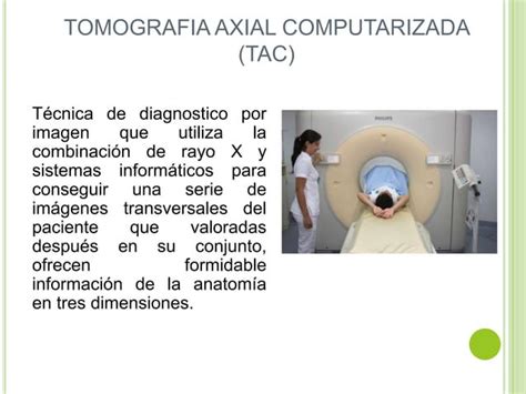 Tomografia Axial Computarizada Tac Tomografia Computarizada