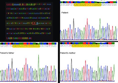 Results of deoxyribonucleic acid sequencing done in the patient as well ...